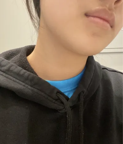 [微整] 뮤임야 - 輪廓針、音波拉提