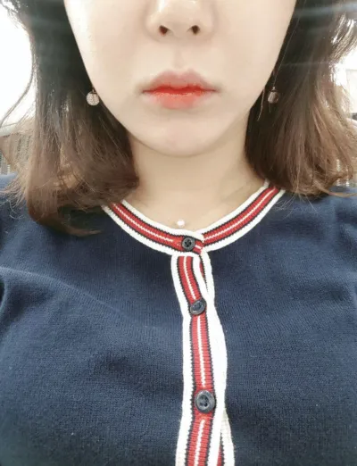 [微整] 전쑈니 - 肉毒桿菌, 香奈兒注射