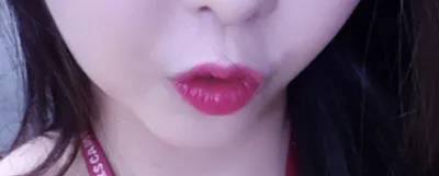 [微整] 黃金比例蕾雅 - 填充劑、埋線拉提