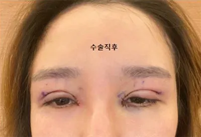 [眼睛] 我的華麗轉變 - 眼睛