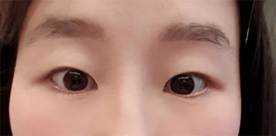 [眼睛]巨牙鯊 - 眼睛