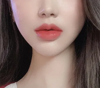 [微整形] 세요링 - 鼻翼肉毒桿菌