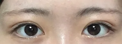 [眼睛] 權東夏 - 眼睛