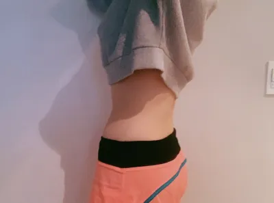 [抽脂] yedu87 - 腿部、腹部抽脂