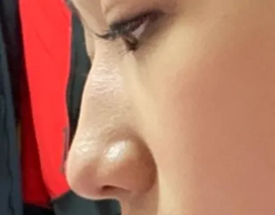 [鼻] 圓鼻頭 - 鼻 (矽膠)