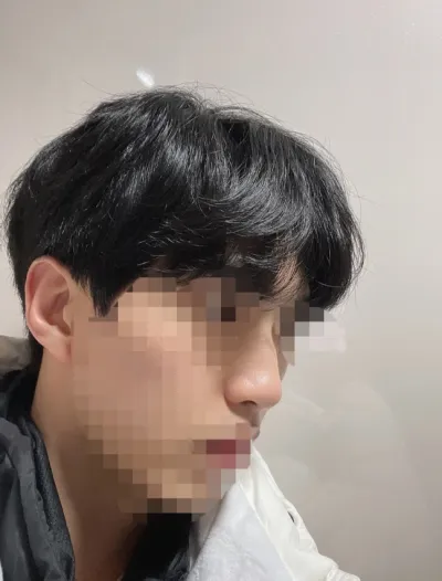 [鼻] Minyaya - 鼻 (矽膠, 鼻中隔軟骨)