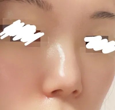 [鼻] 욤이쓰 - 鼻