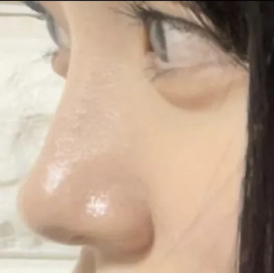 [鼻] 又又伊1 - 鼻