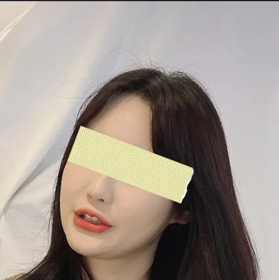 [顏面輪廓] 四角夢想ㅎ - 削骨手術