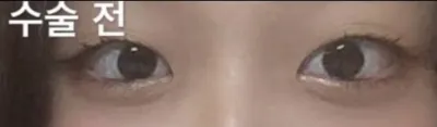 [眼睛] 튀긴감저 - 眼睛