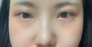 [鼻] 핑쿠팬더 - 眼睛、鼻子