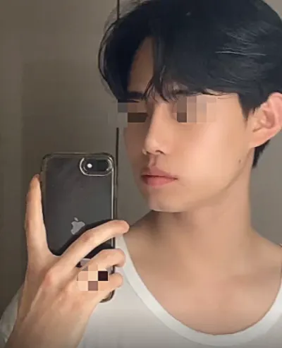 [男性] 熊熊 - 鼻子(美容+機能)