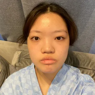 [鼻] Elsa - 眼、鼻