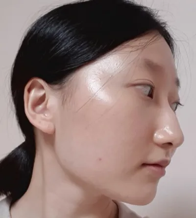 [鼻部] 牙膏 - 鼻