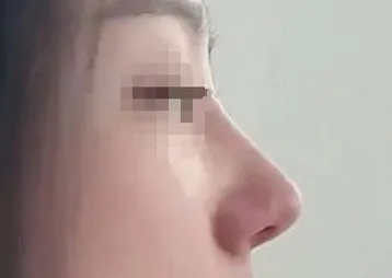 [鼻] Minjjang - 鼻