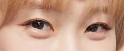 [眼睛] 塔麻可吉 - 眼睛