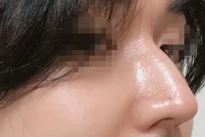 [鼻] 羅伯特 - 鼻