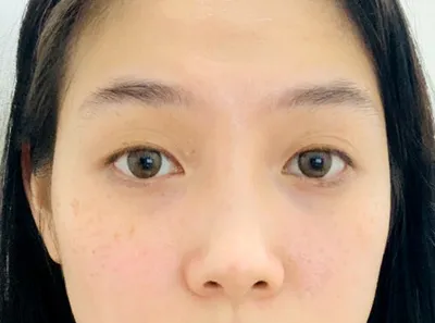 [眼部] 벧걸 - 眼、鼻