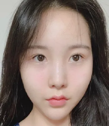 [鼻]烤地瓜 - 鼻