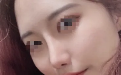 [鼻部] 文文梨 - 鼻部