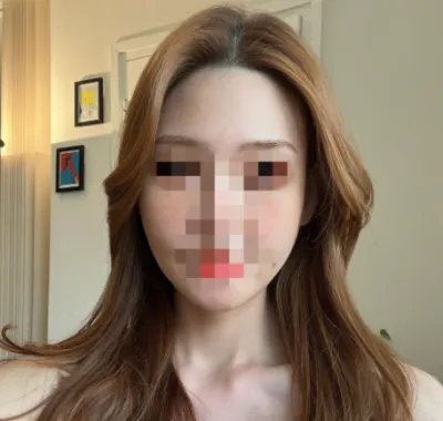 [顏面輪廓] La View v2 - 顏面輪廓