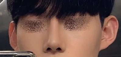 [鼻] 醜照變美照 - 鼻