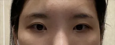 [眼睛] 一切都是 - 眼睛