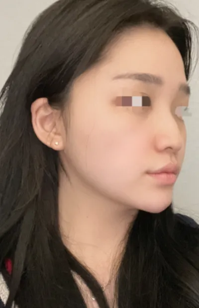 [鼻] 咚咚鏘 - 鼻