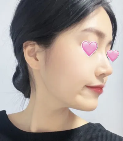 [鼻] Baby Fox - 鼻