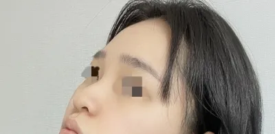 [鼻部] 如季節般 - 鼻部