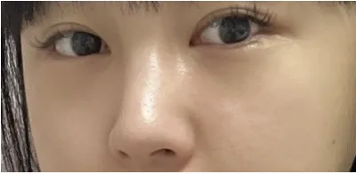 [眼睛] 紅色 - 眼睛、鼻子