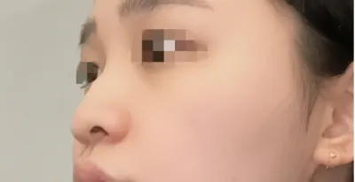 [鼻] 覺得很棒 - 鼻