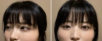 [鼻] 秀氣的鼻子 - 鼻