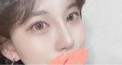 [鼻部] 玩樂最棒 - 眼部、鼻部、額頭拉提