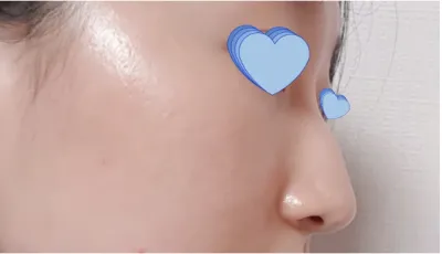 [鼻] 無時無刻想變成美女 - 鼻