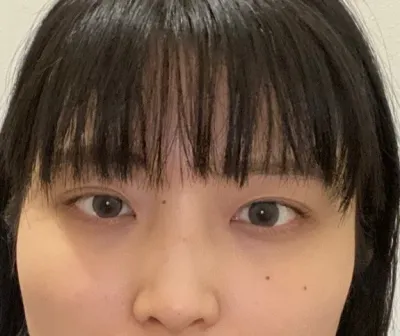 [鼻部] 星光卡比 - 眼部、鼻部