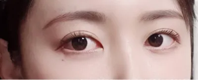 [眼睛] 萊恩春植 - 眼睛