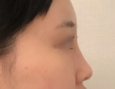 [眼部] 촉호케이쿠 - 眼、鼻