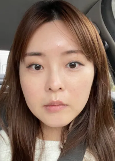 [顏面輪廓] Dr. Moia - 眼部、輪廓、鼻部、臉部抽脂