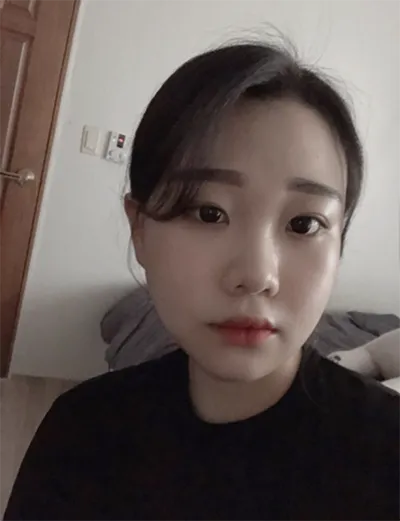 [顏面輪廓] 喵娜喵娜喵 - 顴骨、下顎角、下巴