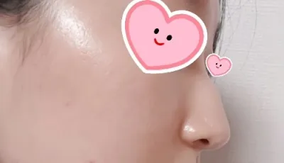 [鼻] 빼꼼이 - 鼻