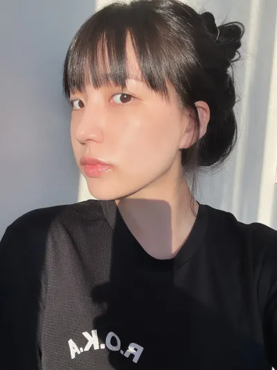 [眼睛] 冬天真好 - 眼睛、臉部脂肪抽吸、脂肪移植