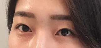 [眼睛] 還是 - 眼睛