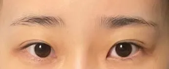 [眼睛] Pocari Sweat - 眼睛