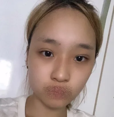 [顏面輪廓] Eclipse - 眼、鼻、輪廓