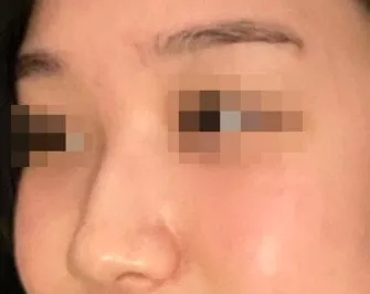 [鼻] 小心感冒 - 鼻