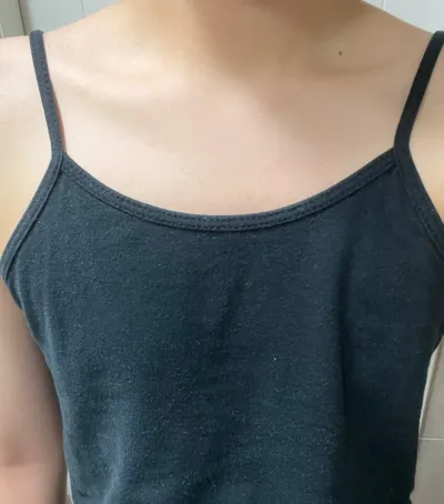 [隆胸] Hot Summer - 隆胸