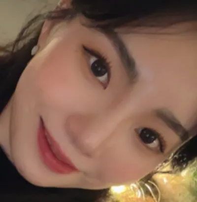 [鼻部] 몽글구름 - 鼻部、脂肪移植