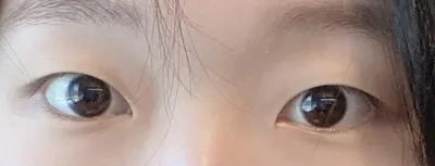 [眼睛] 單眼皮內雙 - 眼睛