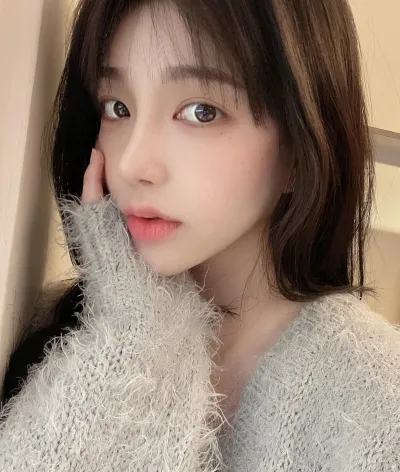 [眼睛] 扁平眼 - 埋線雙眼皮（重修）, 開眼頭, 開眼尾下至